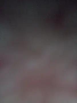 Spider bite online show from 02-23-26, 08:53