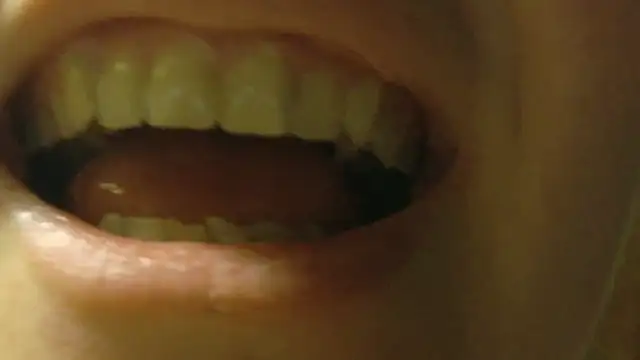 FrumCake online show from 03-23-26, 11:15